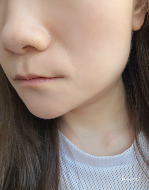 愛爾麗診所 HIPRO-S 龍捲風音波拉提 新登場 非侵入式