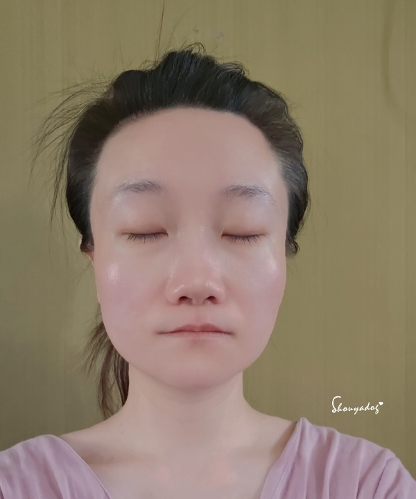 愛爾麗診所 HIPRO-S 龍捲風音波拉提 新登場 非侵入式