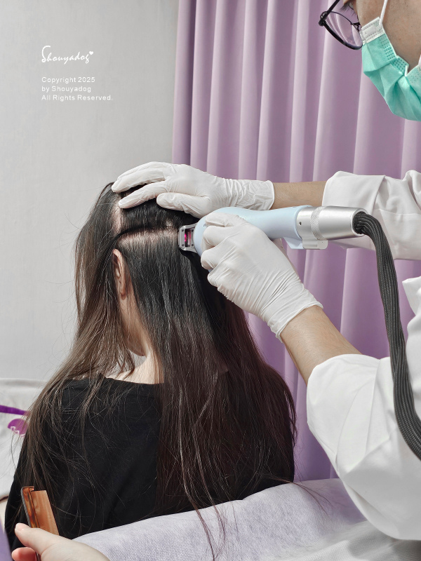 愛爾麗診所頭皮拉髮密雷射 台北拉髮密雷射心得 養髮醫美體驗分