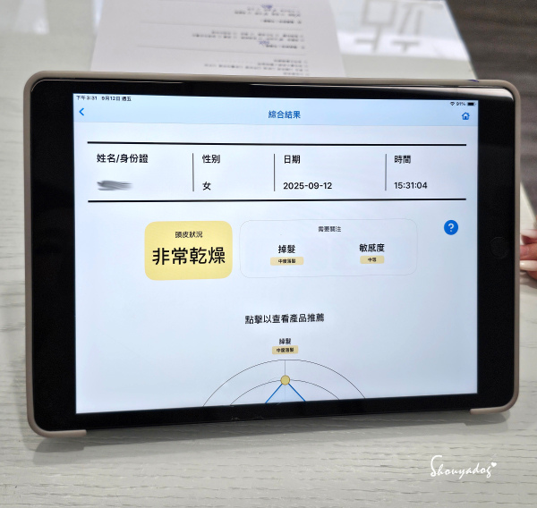 愛爾麗診所頭皮拉髮密雷射 台北拉髮密雷射心得 養髮醫美體驗分