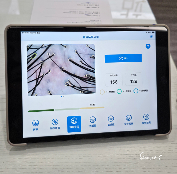 愛爾麗診所頭皮拉髮密雷射 台北拉髮密雷射心得 養髮醫美體驗分