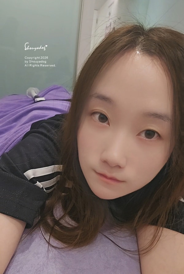 台北體雕推薦｜愛爾麗診所太能波AES：修飾馬鞍肉線條，久坐族容易存肉的收斂小撇步！